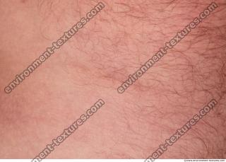 hairy skin white 0003